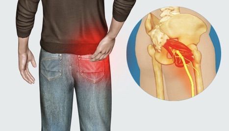 bol u zglobu koljena i bedra liječenje artroze i lijekova za artritis